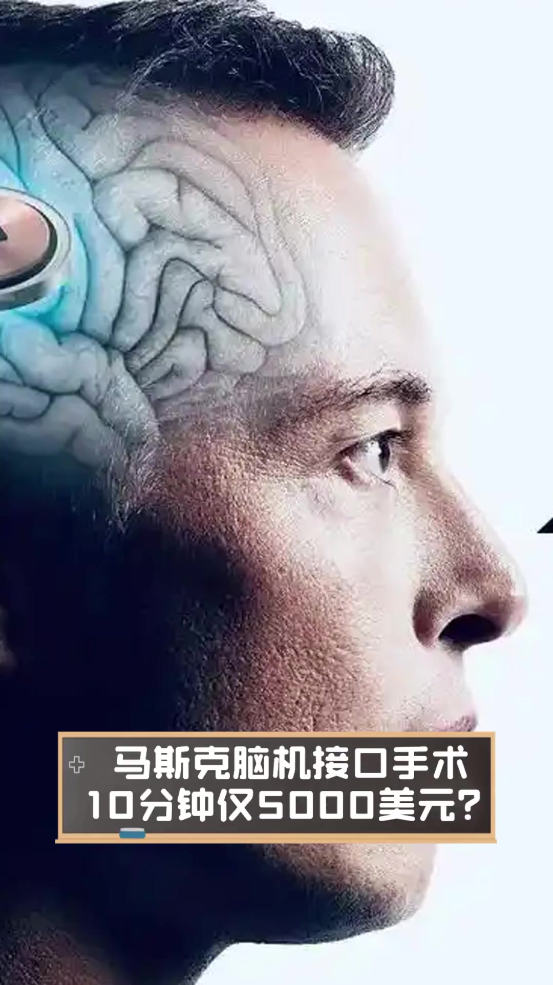 脑机接口技术进入“元年”，投资人直呼“估值太高”